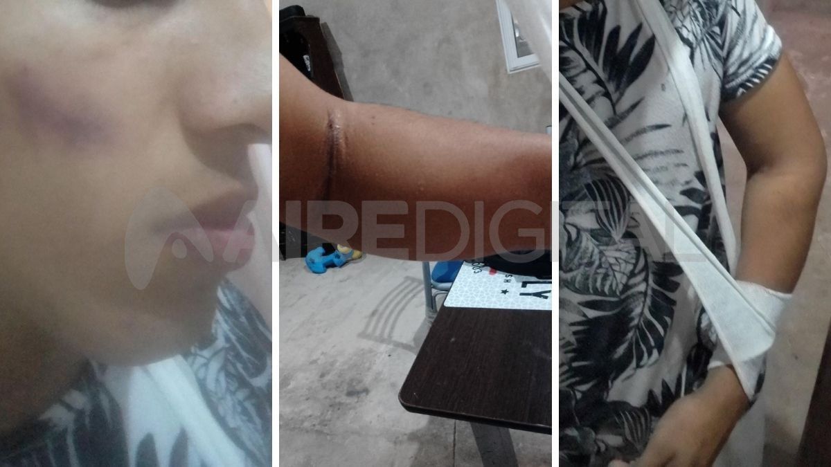 Kevin tiene 22 años y fue brutalmente golpeado por una pareja de ladrones