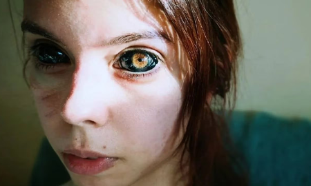 Se tatuó el blanco de los ojos para imitar a un cantante y quedó ciega: Pensé que se vería bien Se tatuó el blanco de los ojos para imitar a un cantante y quedó ciega: Pensé que se vería bien