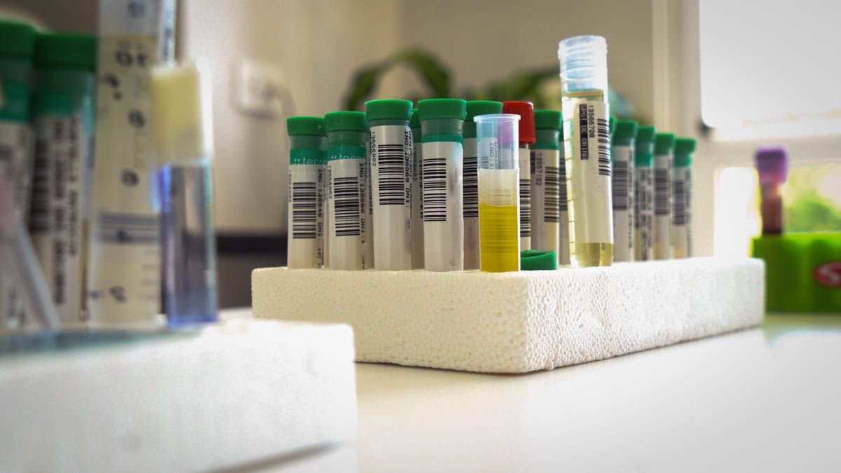 Los estudios de laboratorio se realizan con equipos de última generación. Los estudios de laboratorio se realizan con equipos de última generación.