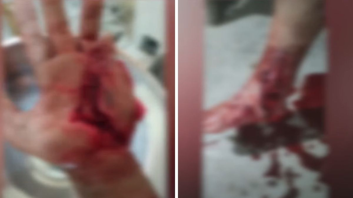 Jabalíes atacaron y mutilaron a un productor ganadero. Jabalíes atacaron y mutilaron a un productor ganadero.