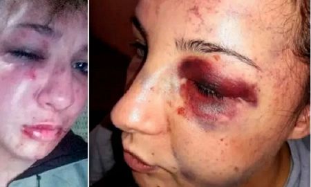 un ex preso desfiguro a trompadas y patadas a su ex y le robo un ex preso desfiguro a trompadas y patadas a su ex y le robo