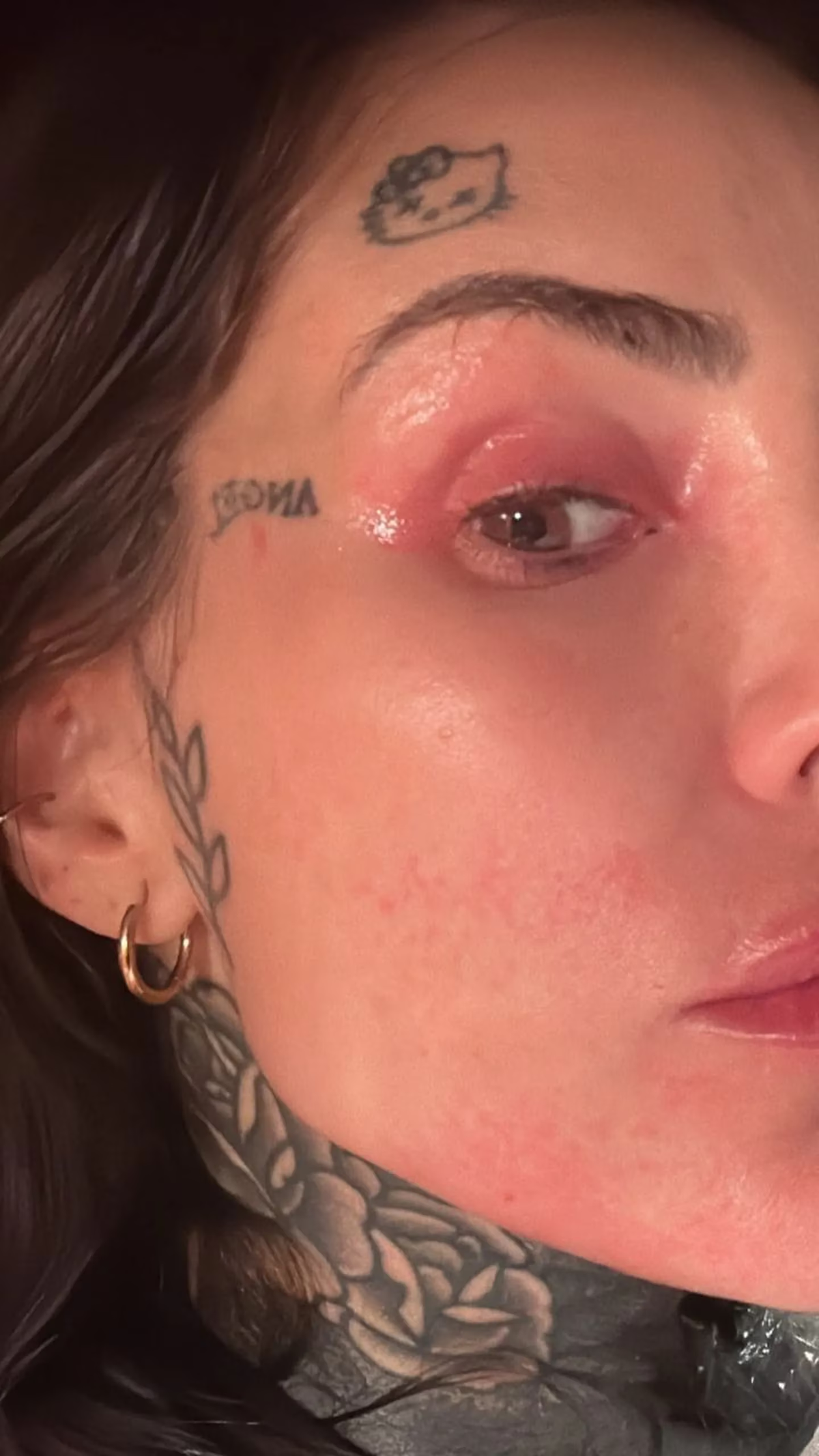 La reacción alérgica de Cande Tinelli.