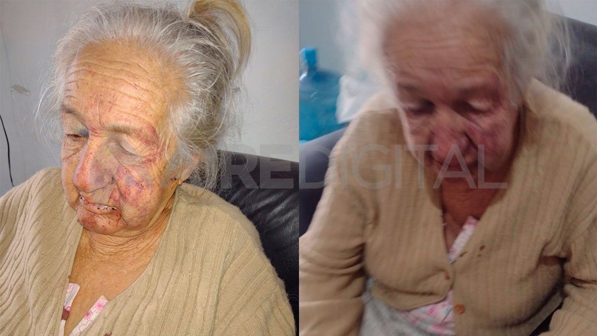 Los golpes fisuraron varias zonas del rostro de la mujer. Los golpes fisuraron varias zonas del rostro de la mujer.