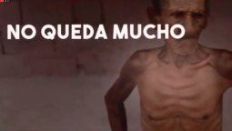 Impactante video sobre Venezuela: desnutrición Impactante video sobre Venezuela: desnutrición
