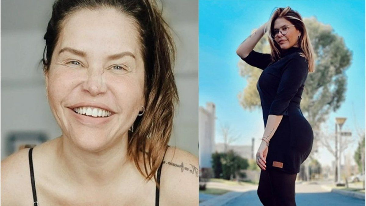 Nazarena Vélez se inyectó Botox en la cara y tuvo una reacción alérgica: Soy un chimpancé &nbsp;