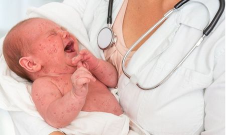 Los médicos del oeste de Texas están realizando clínicas de vacunación para intentar mejorar la aceptación. Los médicos del oeste de Texas están realizando clínicas de vacunación para intentar mejorar la aceptación.