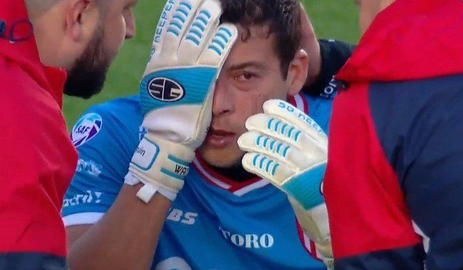 Joaquín Papaleo: “Pude haber perdido el ojo”