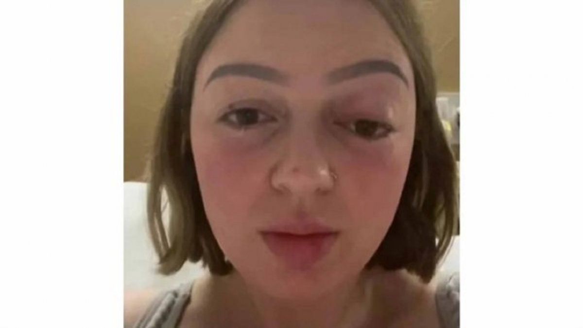 Una mamá hizo tanta fuerza en el parto que un ojo se le salió de su órbita.