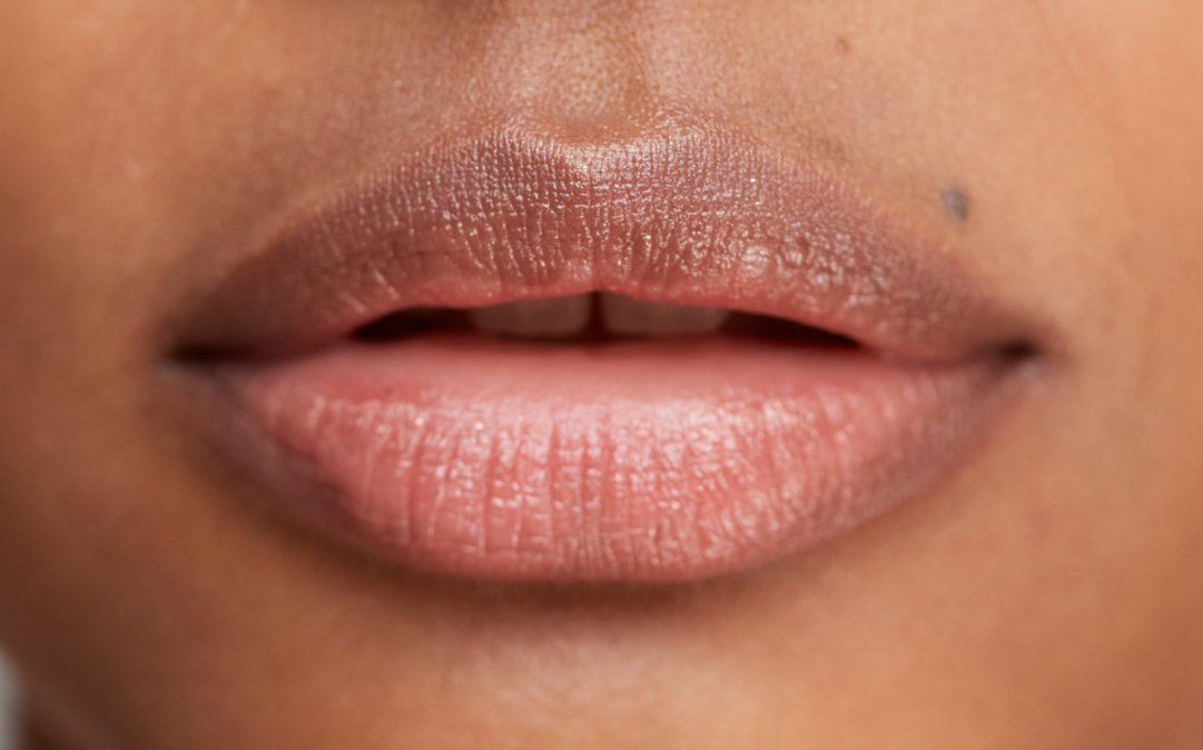 El procedimiento se lleva a cabo a través de una inyección intradérmica.