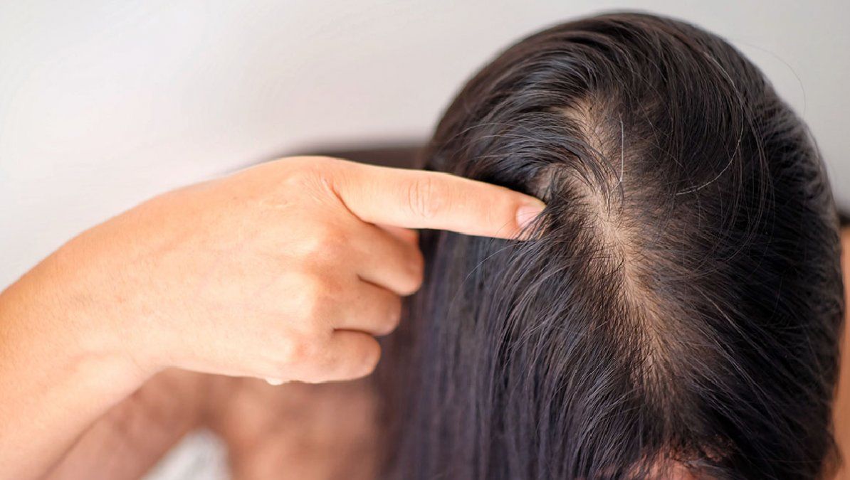 En determinados periodos del año, como otoño o invierno, una persona puede llegar a perder hasta 300 cabellos de forma diaria.