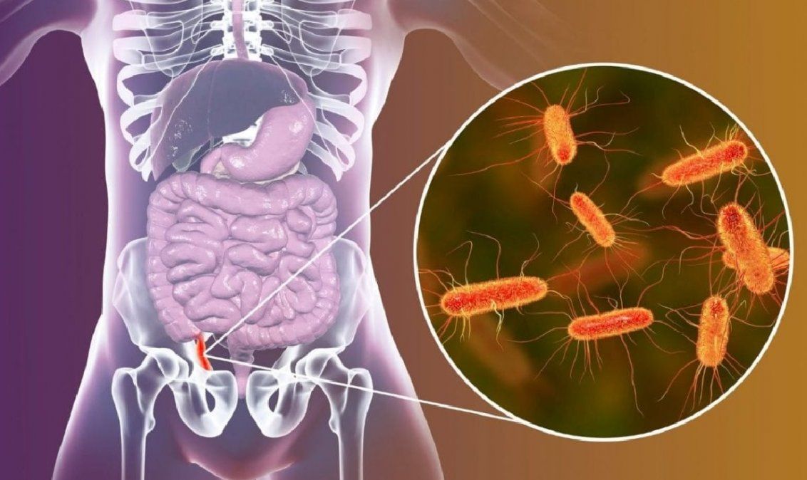 Conocé el mejor ingrediente para desinflamar el intestino