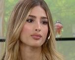 Julieta Poggio mostró la venda en su mano tras sufrir una quemadura en las grabaciones de MasterChef Celebrity.