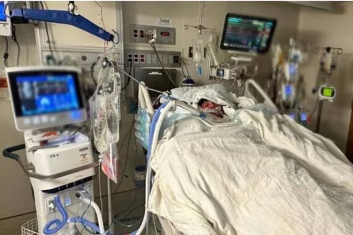 Mazon Dark se encuentra con el 80% del cuerpo quemado y su familia intenta recaudar para solventar los gastos médicos.