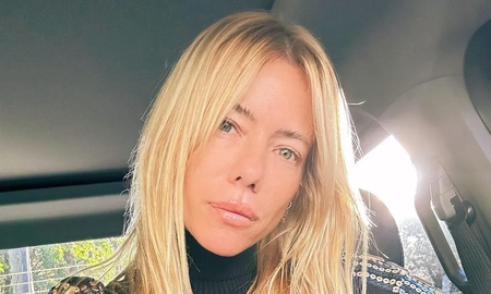 Nicole Neumann se sometió a un procedimiento estético y mostró cómo quedó: Carita de ángel Nicole Neumann se sometió a un procedimiento estético y mostró cómo quedó: Carita de ángel