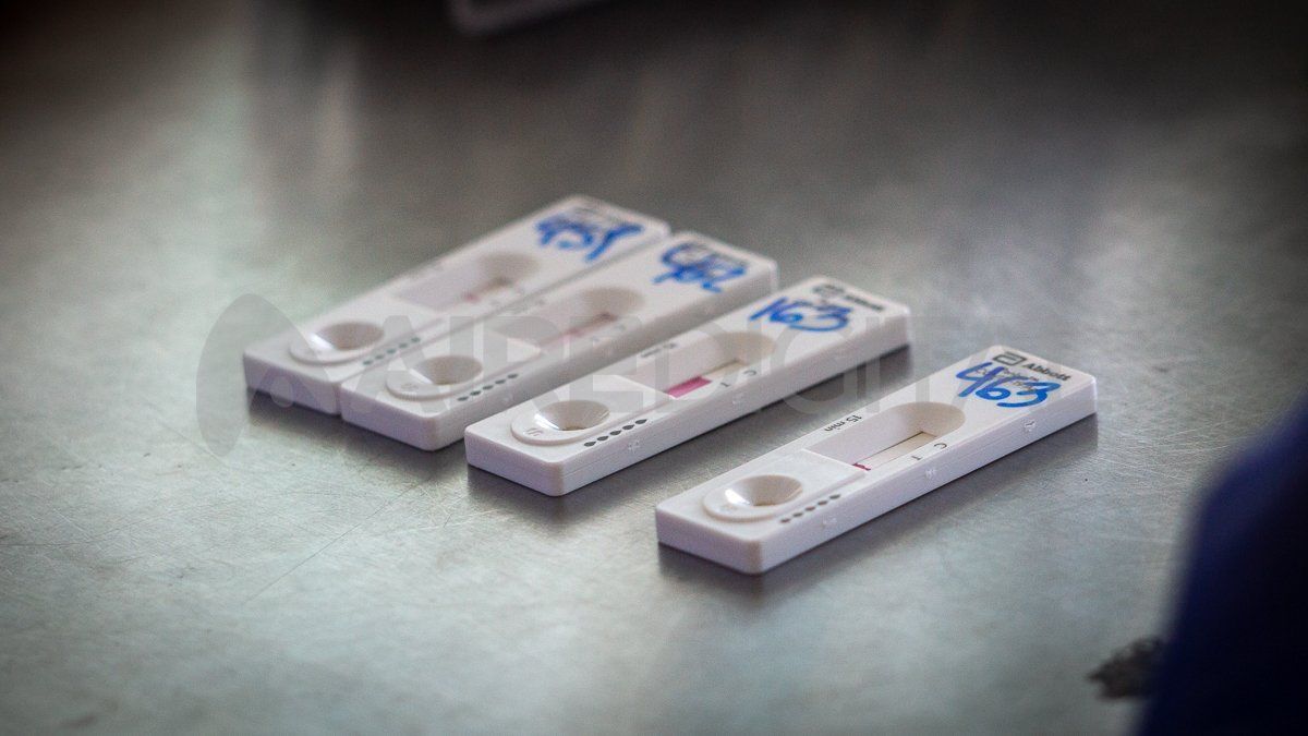 En las últimas 24 horas volvió a bajar la cantidad de testeos realizados, 55.638, con una tasa de positividad del 17,05%.