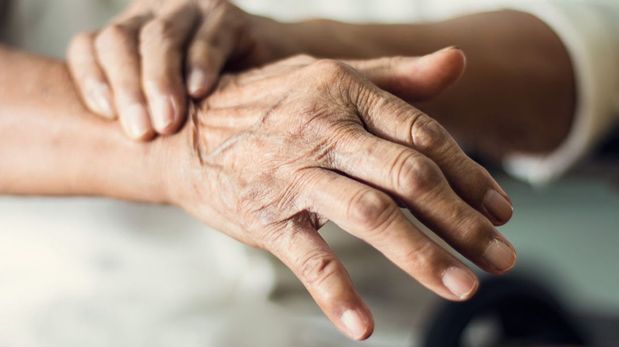 El Parkinson no siempre empieza con temblores: la lentitud en los movimientos es el síntoma clave para el diagnóstico temprano.