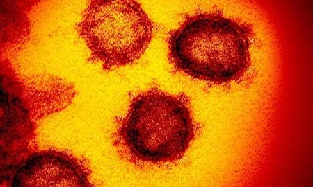 La cepa Épsilon surgió en California y llegó a Argentina a hace un mes. La cepa Épsilon surgió en California y llegó a Argentina a hace un mes.