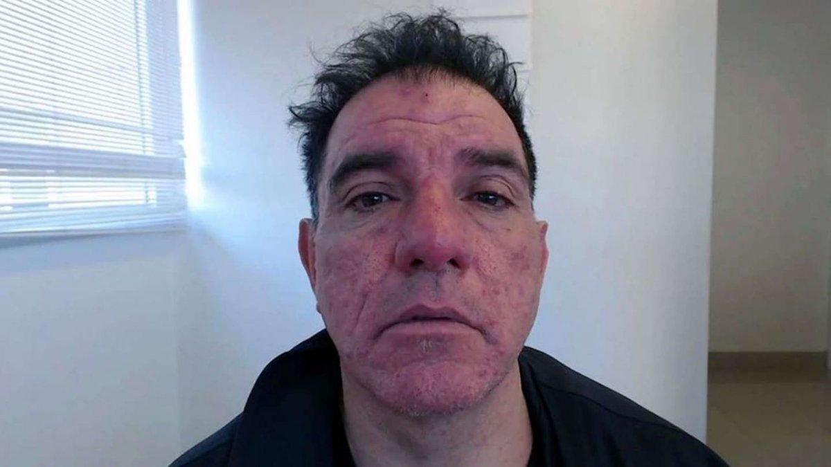 Empaló a su pareja y la mató