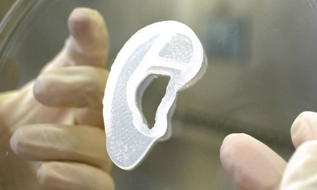 Tuvo que llevar su oreja implantada en su pie durante meses. Tuvo que llevar su oreja implantada en su pie durante meses.