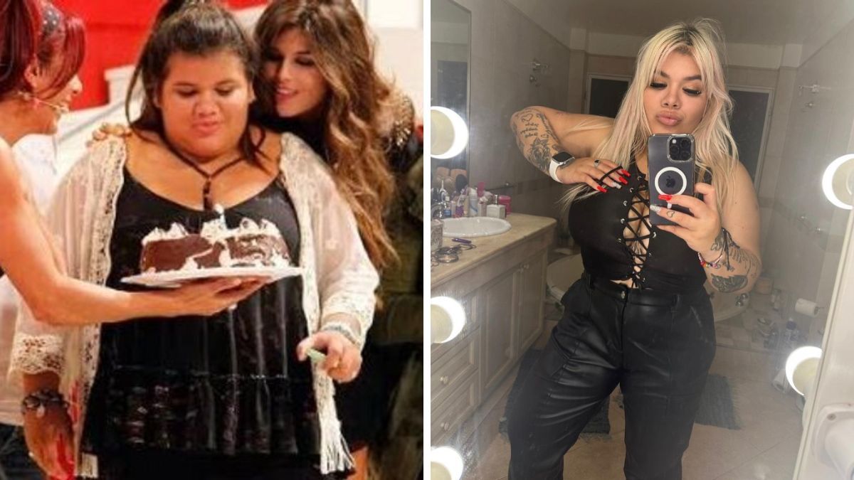 La influencer se sometió a varias cirugías estéticas y no tiene vergüenza en confesarlo.