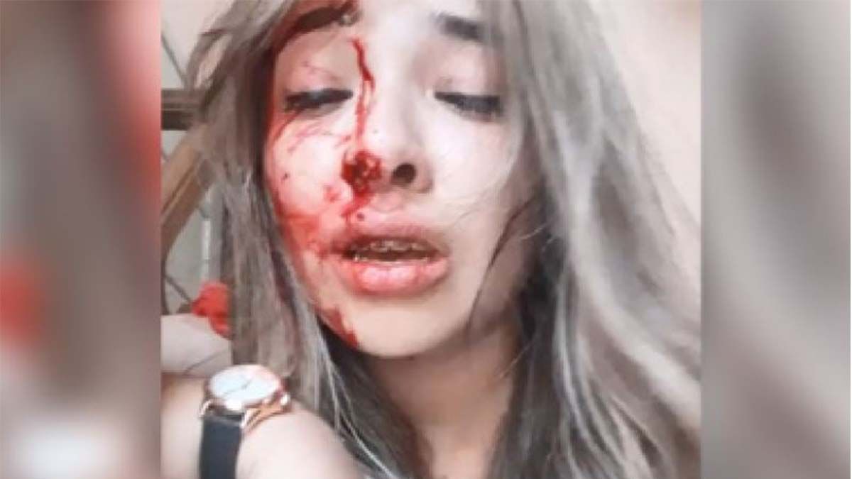 Video: una joven mostró su rostro desfigurado por los golpes de su pareja