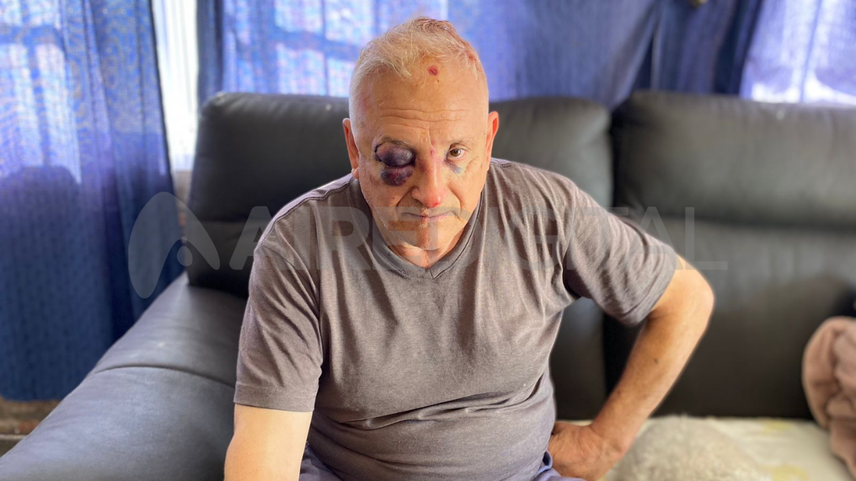 El hombre de 67 años sufrió una violenta entradera el jueves por la noche en su casa ubicada en el km 19 de Arroyo Leyes.