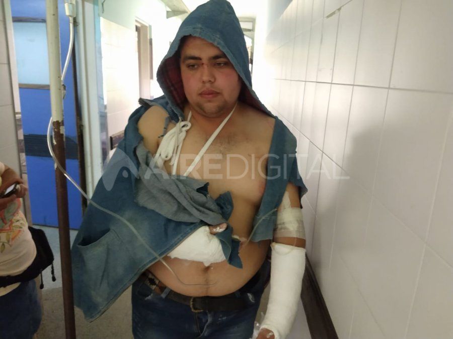 Alexis Lencina es el joven de Coronda accidentado en el vuelco del colectivo en avenida Circunvalaci&oacute;n