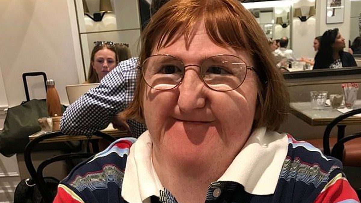 Le dijeron que no podía subir selfies porque era muy fea, los enfrentó de la mejor manera y se hizo viral