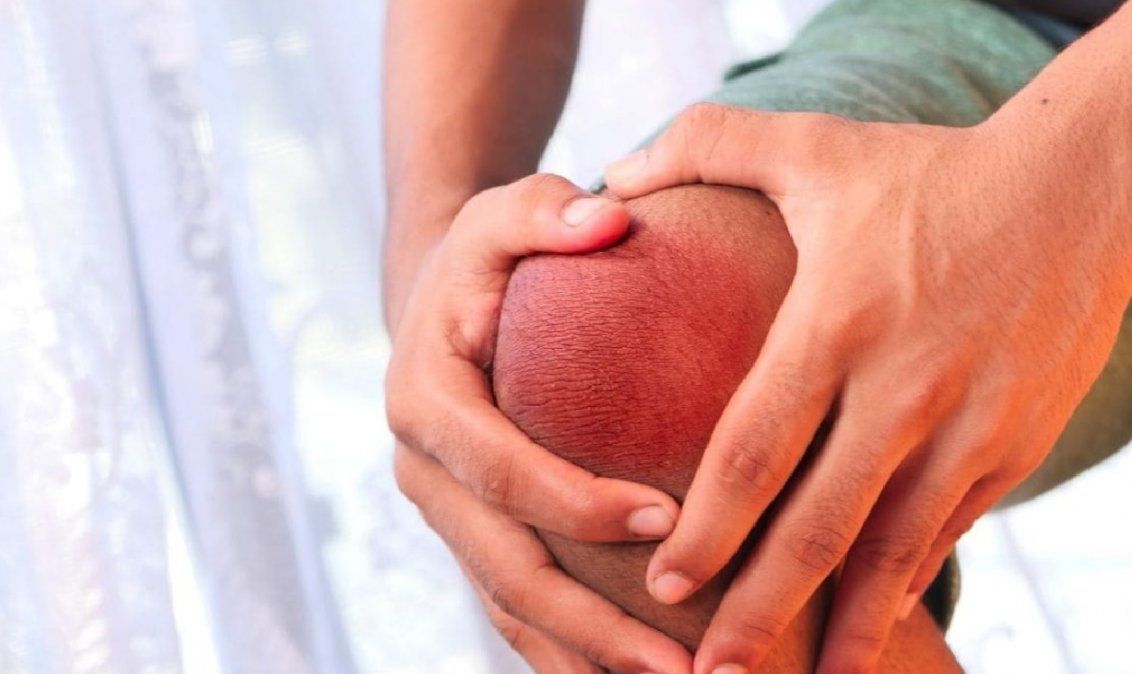 Alimentos saludables con beneficios para las articulaciones