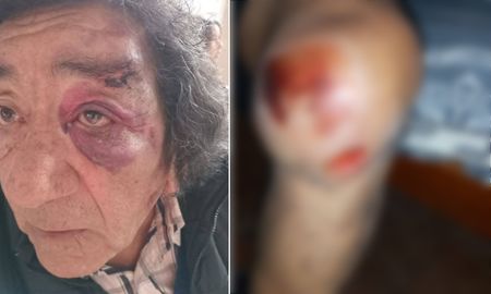 Tito Frías, integrante del Grupo Alegría, atropellado por un vehículo que se fugó Tito Frías, integrante del Grupo Alegría, atropellado por un vehículo que se fugó