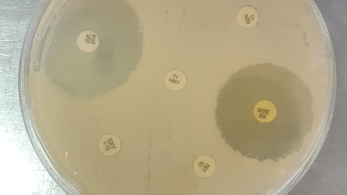 Prueba de sensibilidad a diferentes antibióticos. Prueba de sensibilidad a diferentes antibióticos.