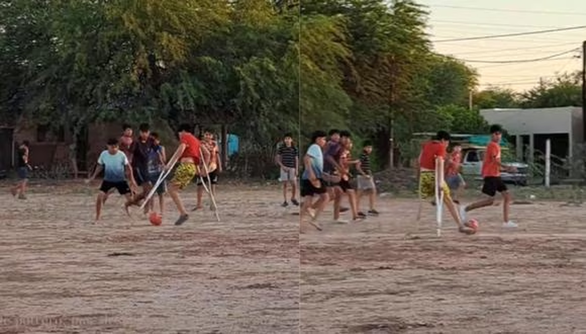 Un niño con una sola pierna fue filmado jugando a la pelota y emocionó a todos.
