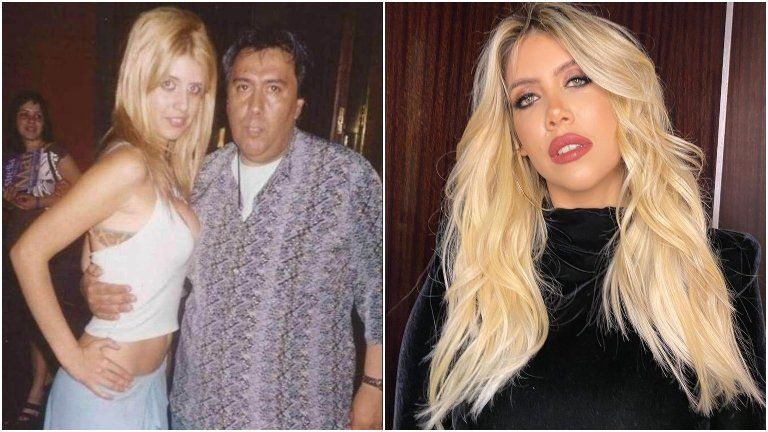 El impactante antes y después de Wanda.