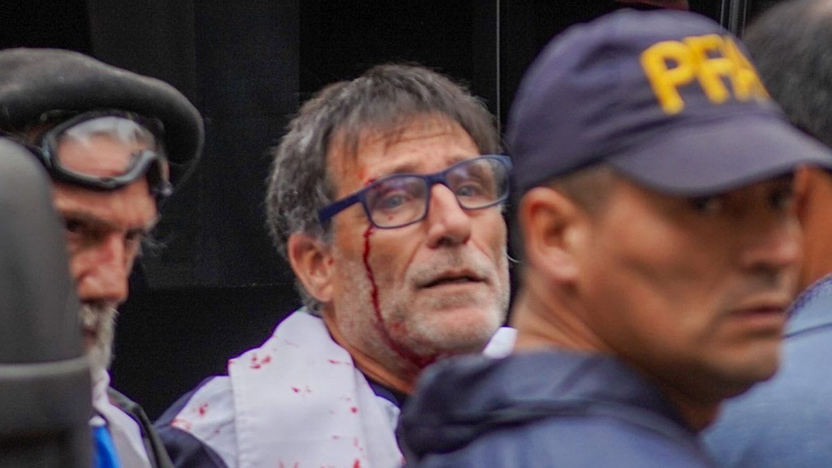 “Los que están mal son los jubilados, el cura no importa. Estábamos en la primera fila, dando la vuelta al Congreso, y en un momento empezaron a empujarnos fuerte y tiraron a una jubilada”, relató el padre Paco. “Los que están mal son los jubilados, el cura no importa. Estábamos en la primera fila, dando la vuelta al Congreso, y en un momento empezaron a empujarnos fuerte y tiraron a una jubilada”, relató el padre Paco.
