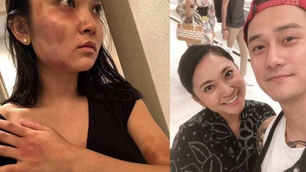 El horror de una modelo: “Me golpeaste hasta que aborté a tu hijo”