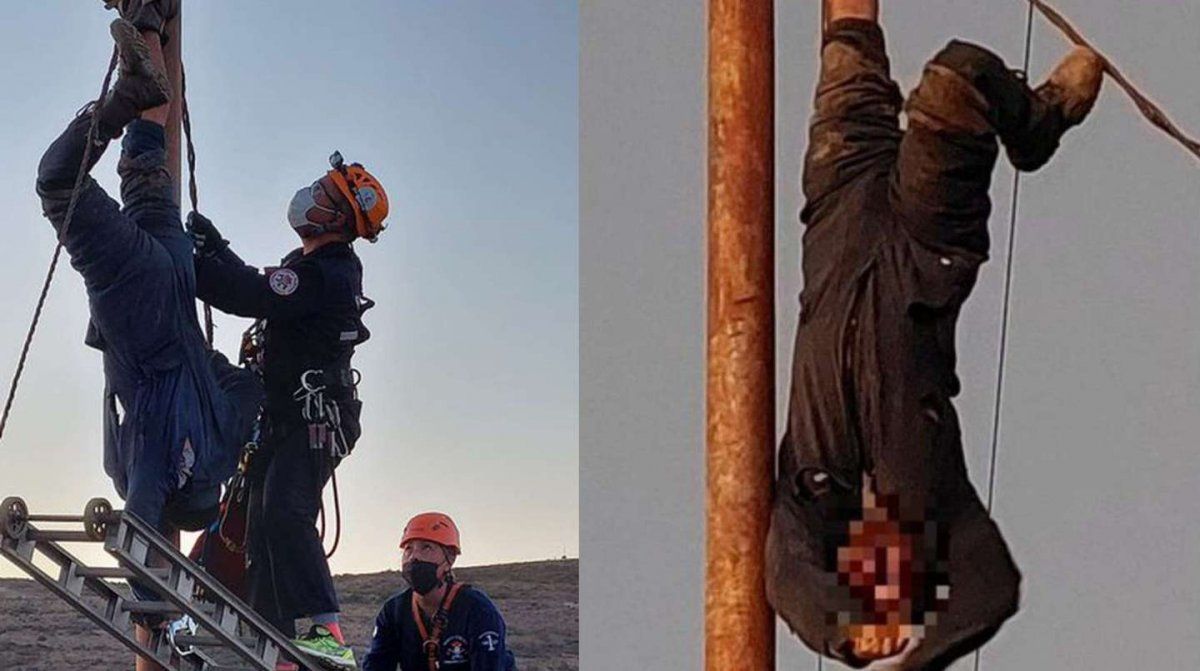 Le amputarán el brazo al hombre que se trepó a robar cables y quedó electrocutado