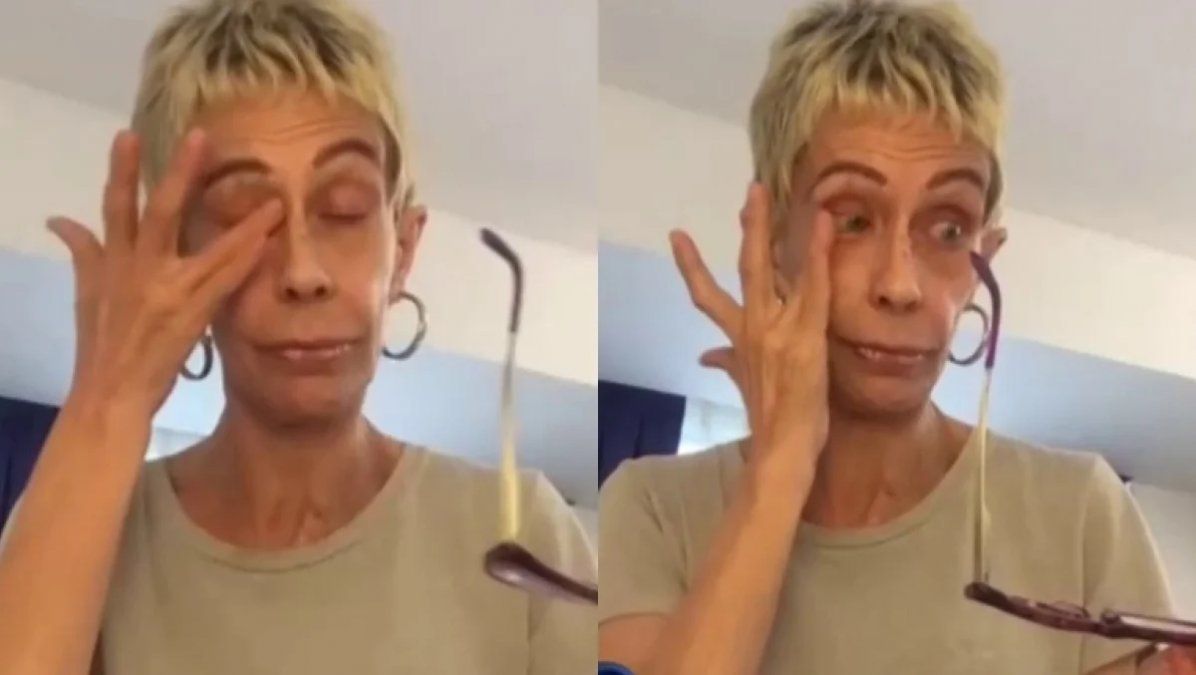 Muelas de vaca: de qué se trata la dolencia que afecta la salud de María Valenzuela