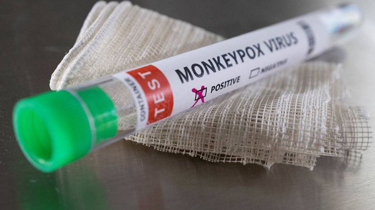 El Ministerio de Salud  confirmó el cuarto caso de viruela símica en la provincia de Santa Fe. 