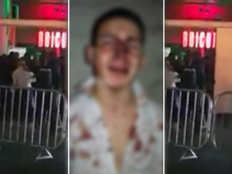 Gritos, trompadas y sangre: así “noqueó” el patovica a un joven santafesino