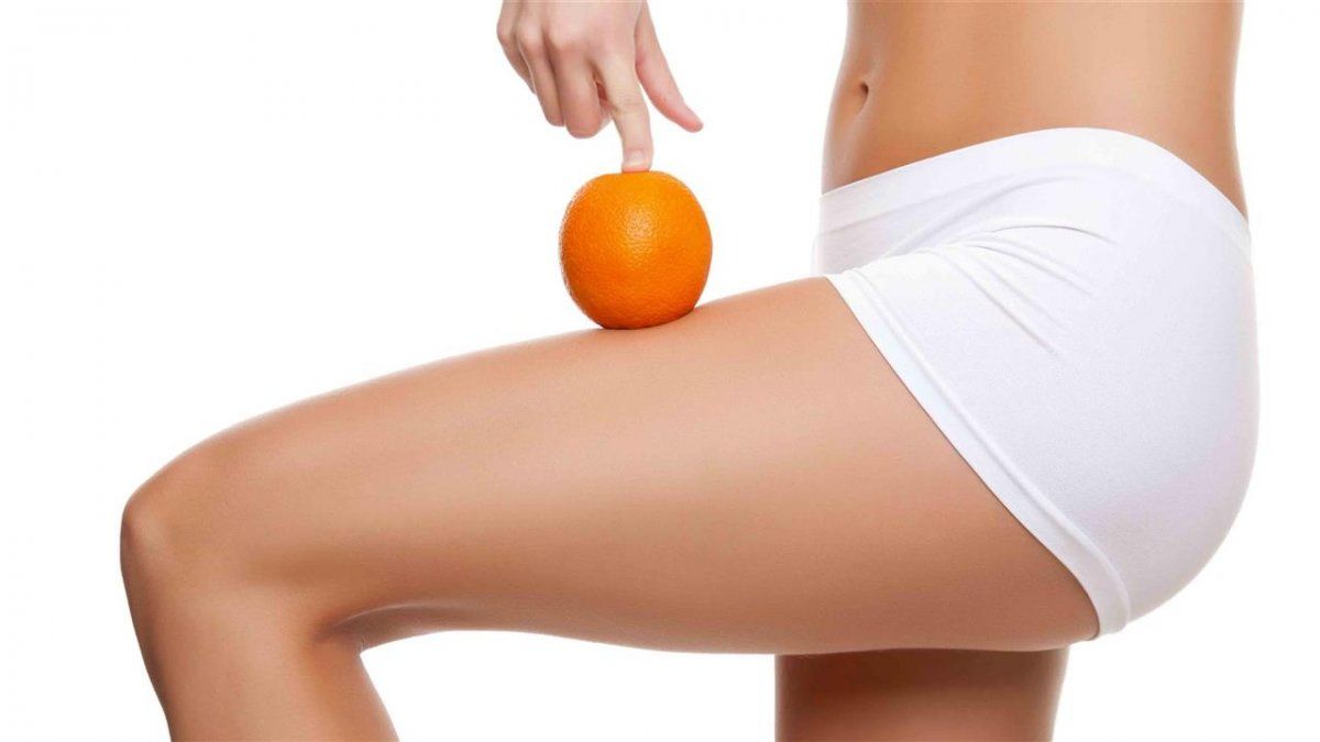 Celulitis: un abordaje natural en cuatro pasos