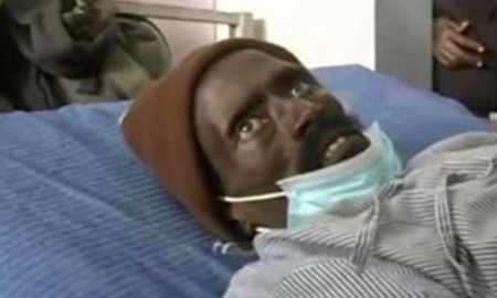 Fue dado por muerto y se despertó cuando lo inyectaron para embalsamarlo Fue dado por muerto y se despertó cuando lo inyectaron para embalsamarlo