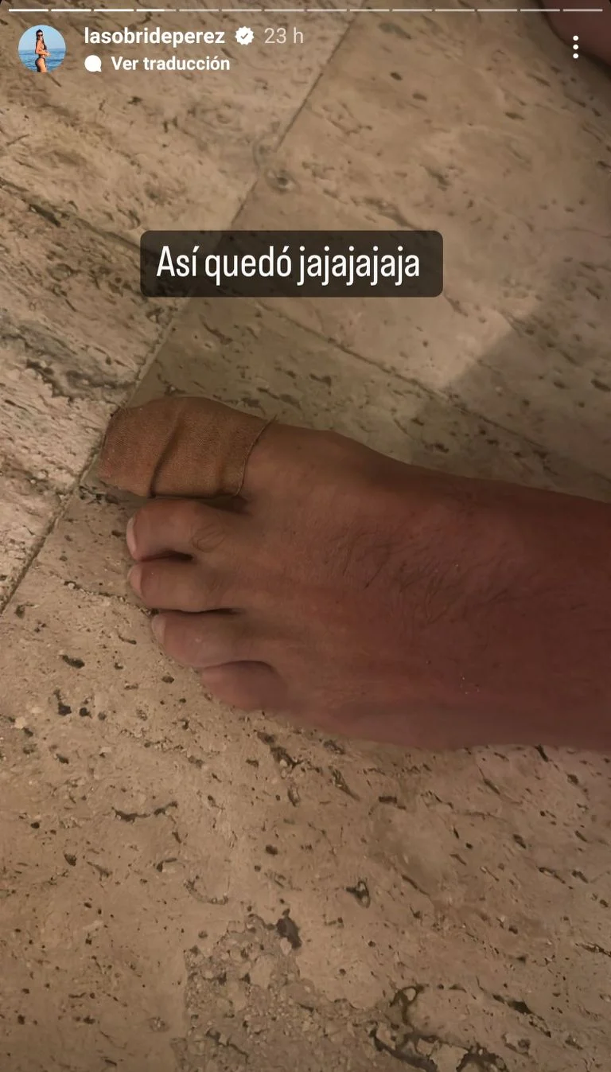 Sol Pérez enseñó el accidente que tuvo Guido Mazzoni.