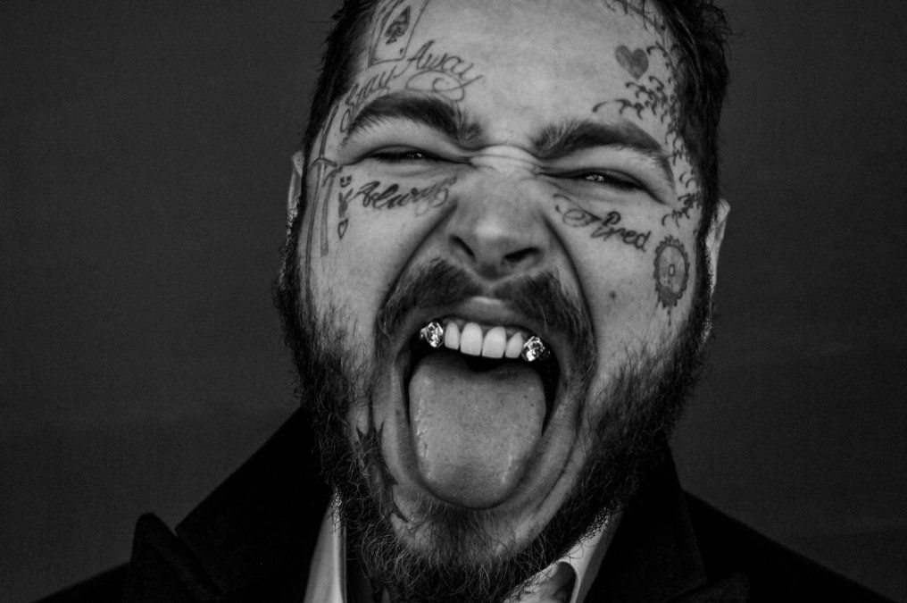 Post Malone se incrustó dos colmillos de diamantes de 12 quilates y se suma a la moda de las dentaduras millonarias que inauguró Lil Uzi Vert.