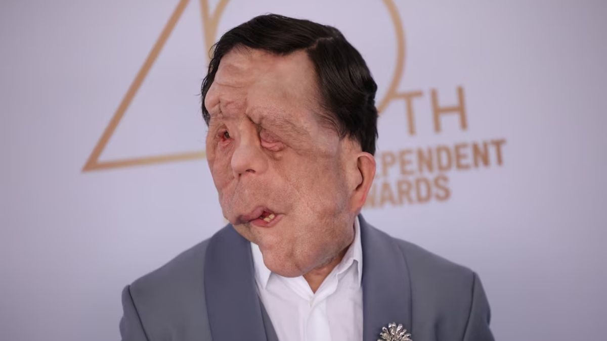 Adam Pearson deslumbró con un traje de Amiri y accesorios de lujo