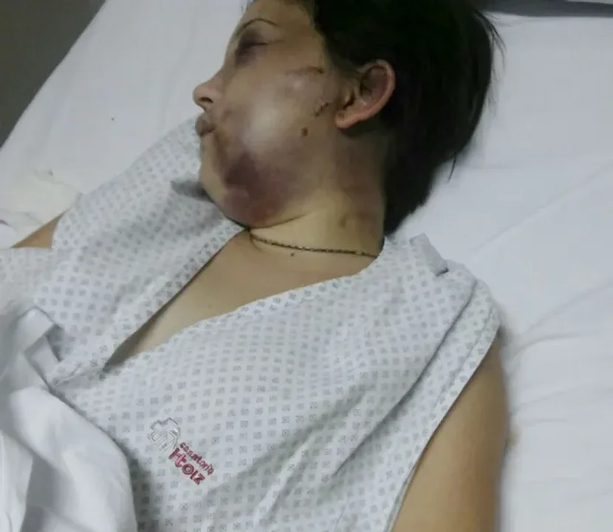 La víctima publicó imágenes de las lesiones generadas por el anestesista después del ataque. Fotografía: Agencia Noticias Argentinas / redes La víctima publicó imágenes de las lesiones generadas por el anestesista después del ataque. Fotografía: Agencia Noticias Argentinas / redes