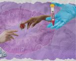 El uso de preservativos es esencial para la salud sexual. El uso de preservativos es esencial para la salud sexual.