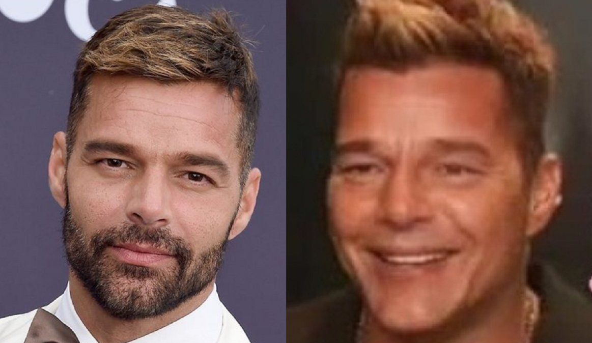 Qué le pasó en la cara a Ricky Martin: el artista sorprendió al posar con un rostro totalmente cambiado