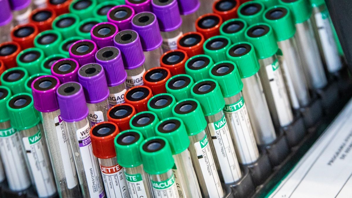 El estudio permite verificar la compatibilidad de pacientes hipersensibilizados con el órgano a trasplantar.