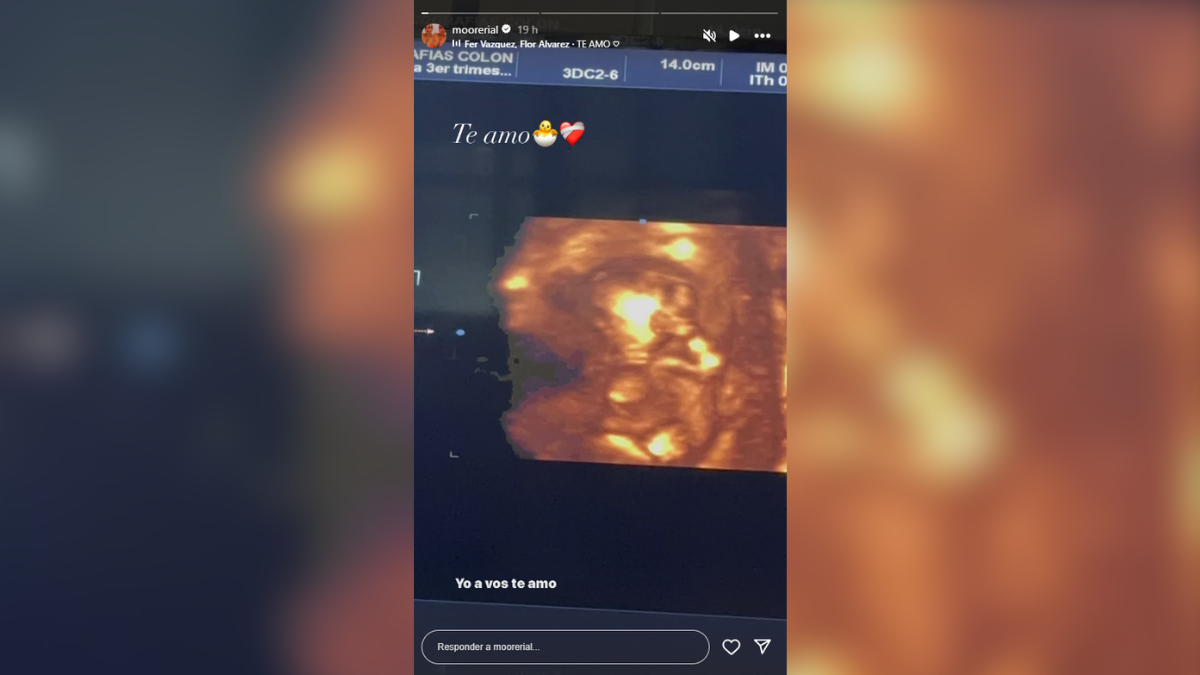 More Rial compartió una ecografía de su segundo hijo en su cuenta de Instagram. More Rial compartió una ecografía de su segundo hijo en su cuenta de Instagram. 