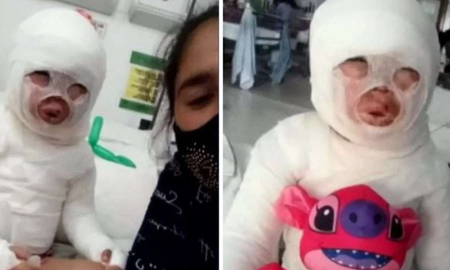 Quemaron con aceite hirviendo a una nena de tres años en un restaurante de Florencio Varela Quemaron con aceite hirviendo a una nena de tres años en un restaurante de Florencio Varela